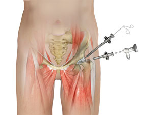 Arthroscopy of the Knee